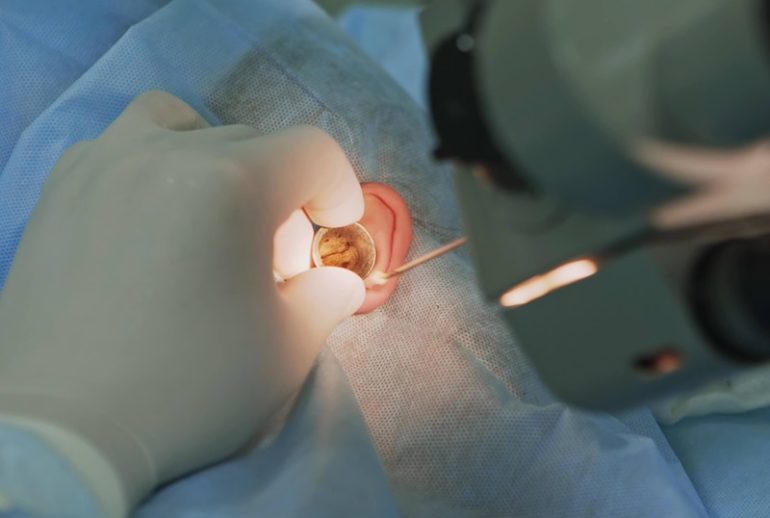 دکتر جراحی میکرو گوش - اصفهان